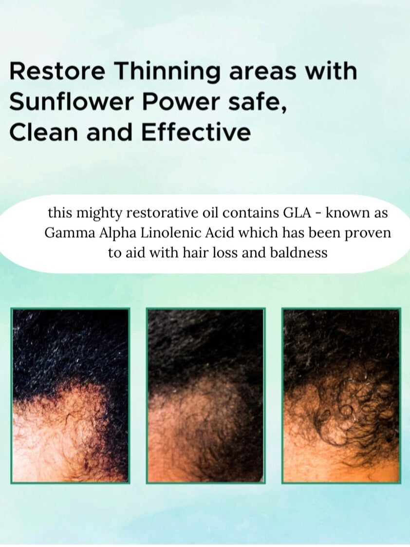 Recover Restore Gro - Root Growth Elixir 4oz - 2