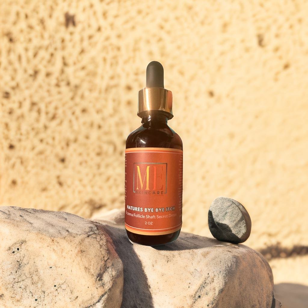 MS - Nature’s Bye Bye Itch™ Scalp & Growth Hair Oil – Nourish, Soothe, and Strengthen