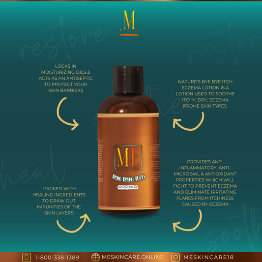 MS - Nature’s Bye Bye Itch™ Moisture Lock Lotion – Calming Hydration for Sensitive Skin